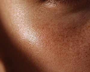 Close-up of skin texture on face