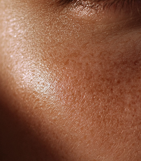 Close-up of skin texture on face